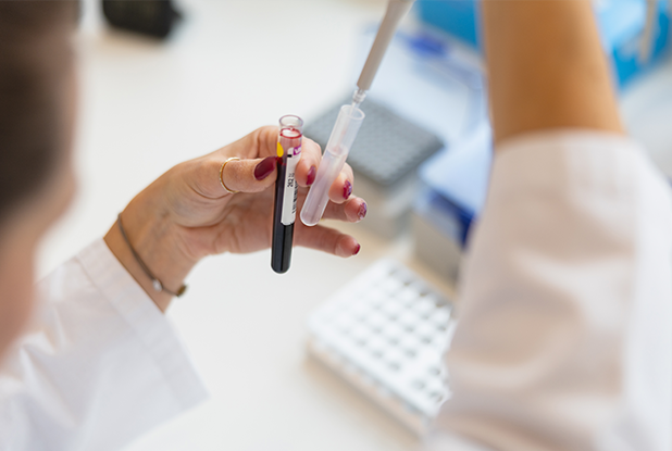 Recherche & Développement (R&D)